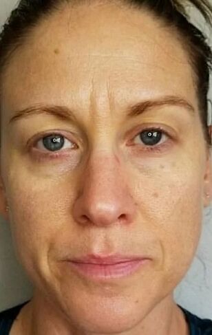 By the age of 40, deep wrinkles and age spots appeared