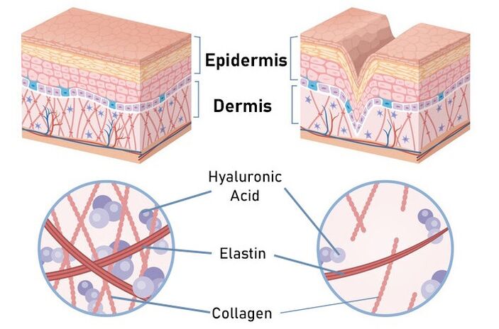 Simpla 360 stimulates collagen synthesis