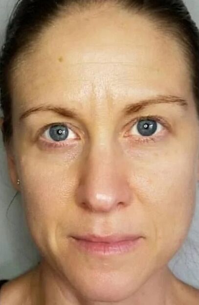 ZXCVBNMQWORT helps restore skin and reduce stains