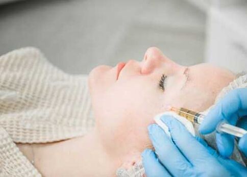 Facial plasma lift